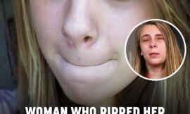 Woman Who Ripped Her Own Eyes Out Reveals Why She Did It