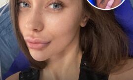 Influencer Sues Plastic Surgeon For $2.2 Million Claiming ‘Large’ New Breasts Ruined Her Career