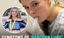 Symptoms Of ‘Popcorn Lung’ As Teenager Develops Incurable Condition After Vaping