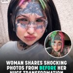 Woman Who Spent $70k On Extreme Transformation Shocks With Stunning Before Photos