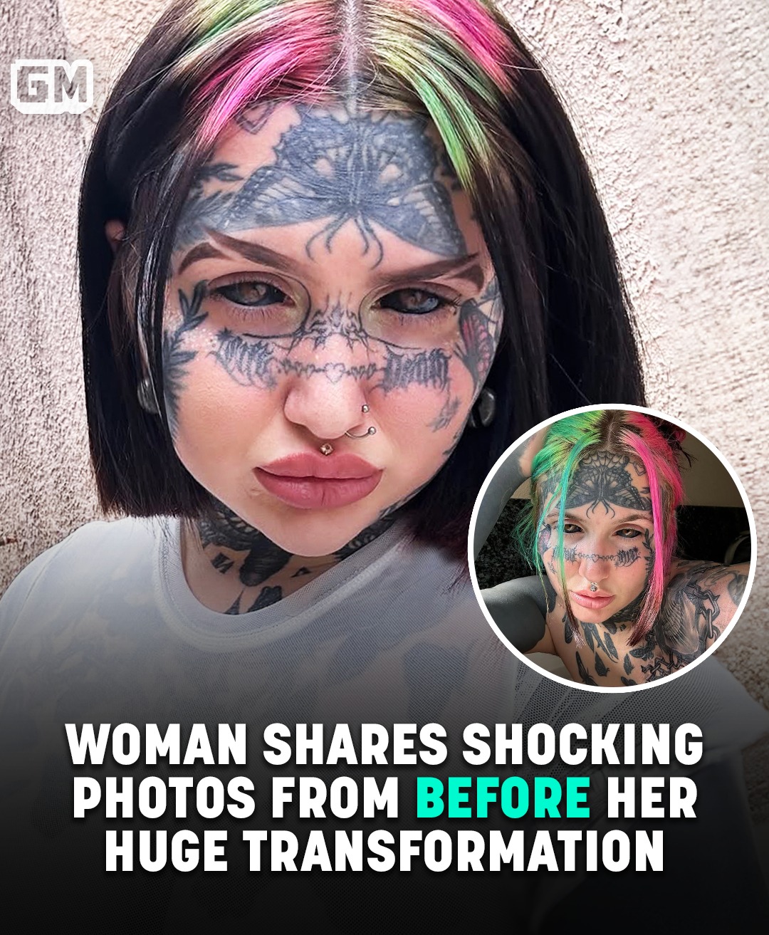 Read more about the article Woman Who Spent $70k On Extreme Transformation Shocks With Stunning Before Photos