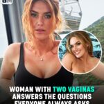 Woman With Two V**inas Answers The Questions Everyone Always Asks