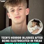Teenager Almost Dies In Freak Phone Charger Accident