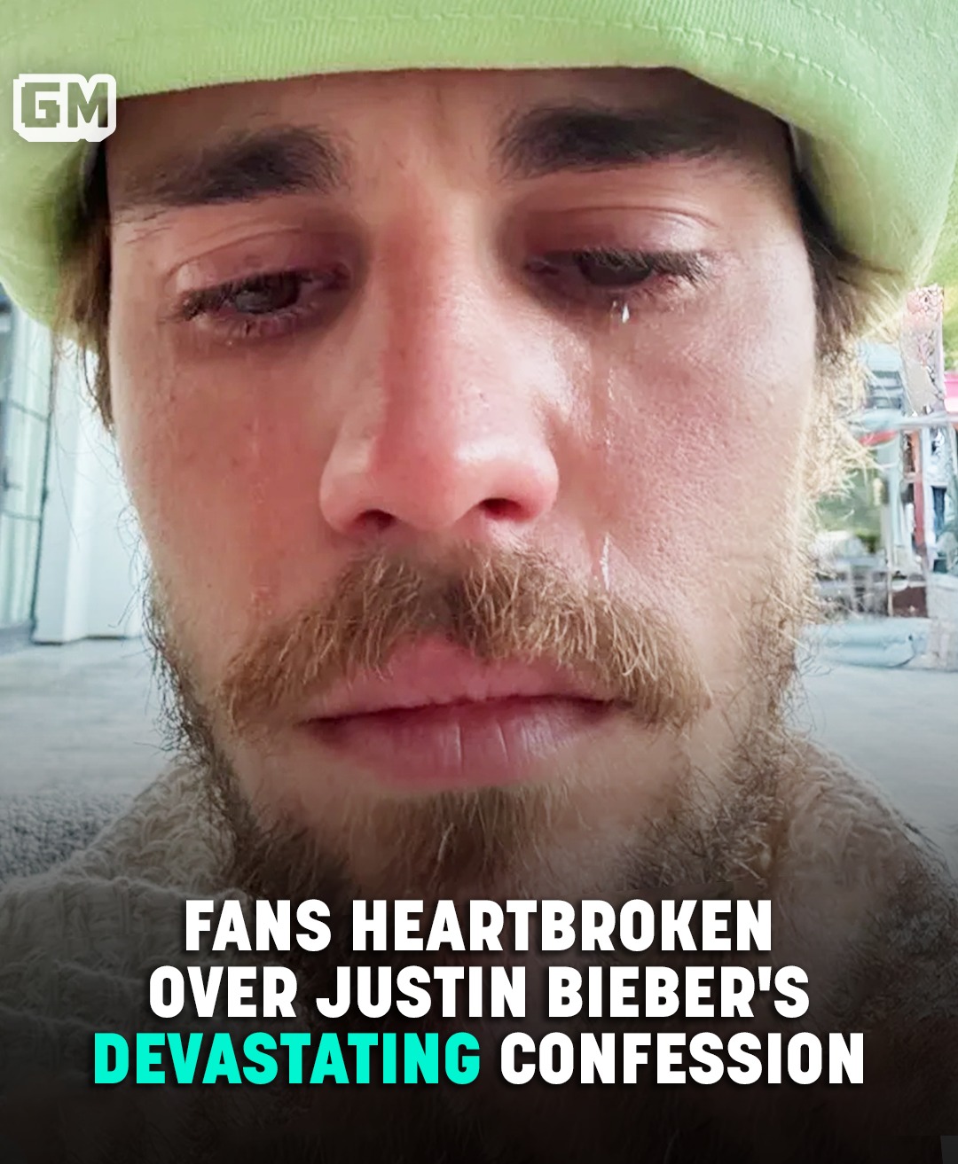Read more about the article Justin Bieber’s Devastating Confession Leaves Fans In Tears Amid Health Concerns