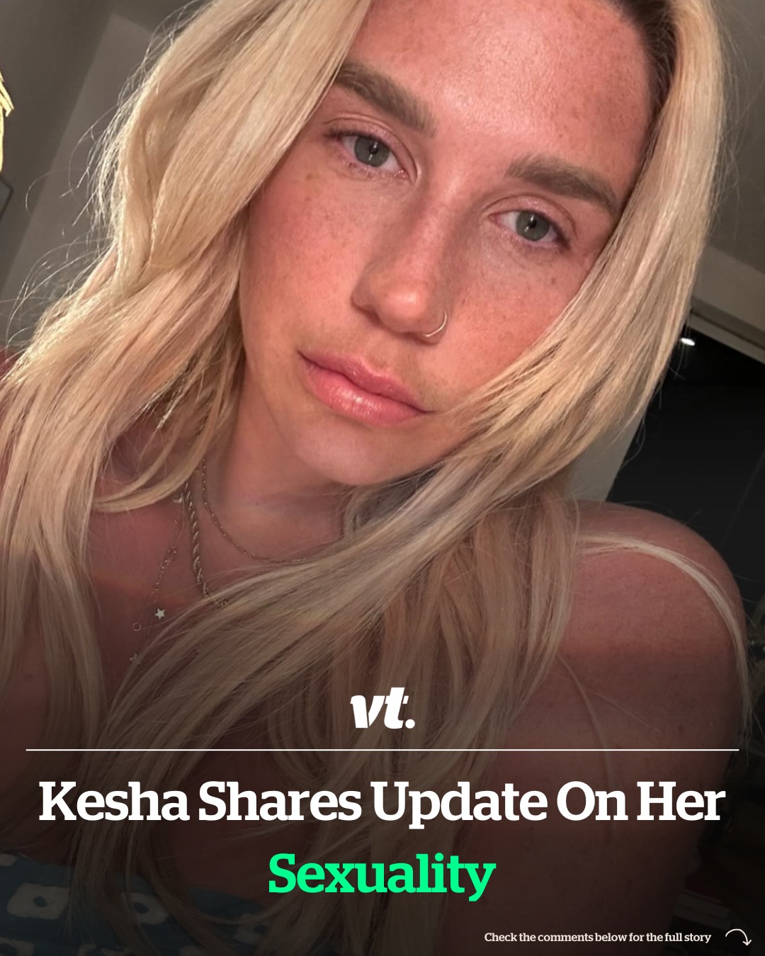 Read more about the article Kesha shares update on her sexuality