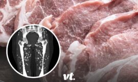 Doctor shares horrifying scan showing patient’s legs after eating undercooked pork