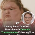1000-lb Sisters star Tammy Slaton unveils huge transformation after skin removal surgery