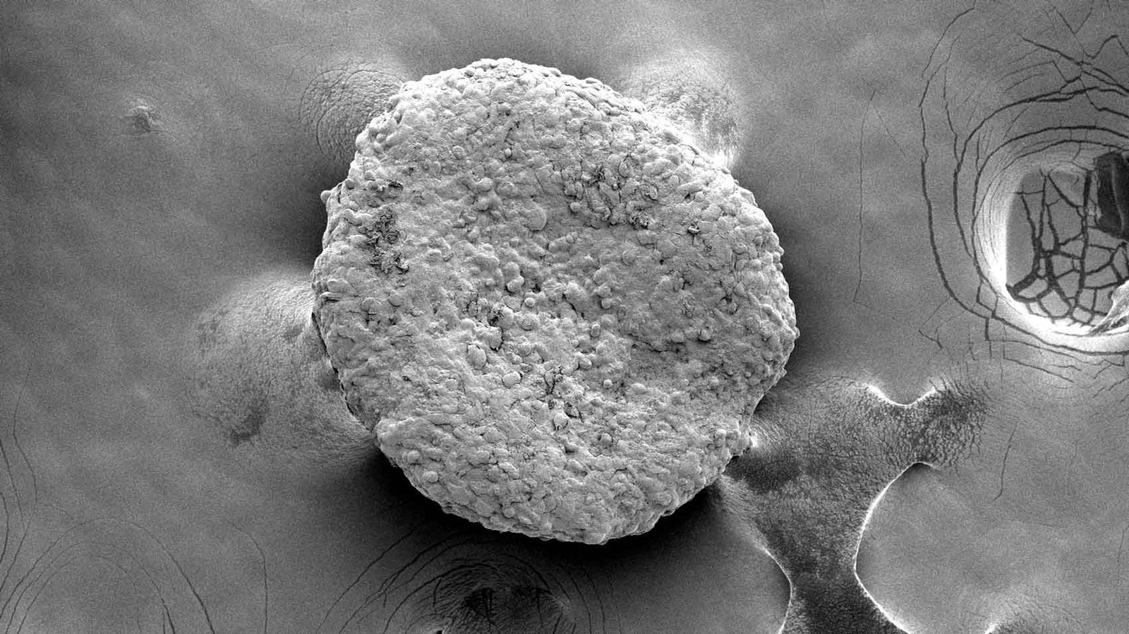 You are currently viewing “Hungry” Fat Cells Could Fight Cancer by Devouring Tumors’ Food Sources, Study Suggests